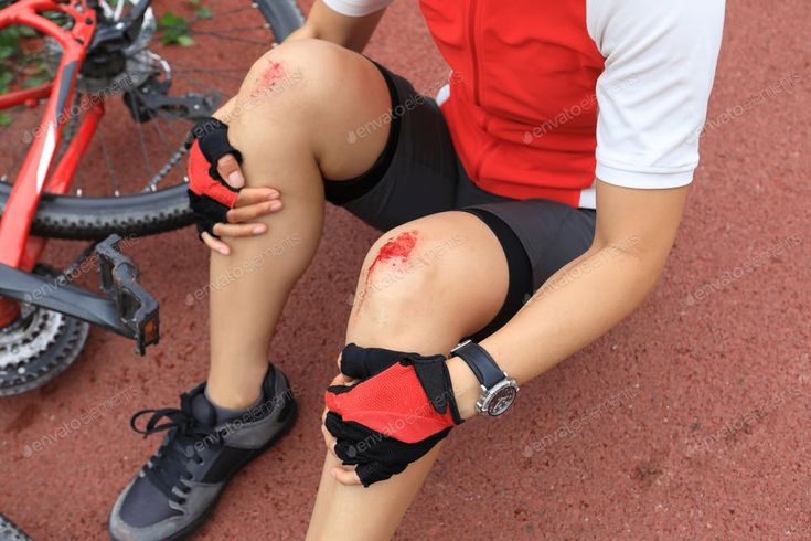 Cycling Injuries: Common Causes, Prevention, and Recovery